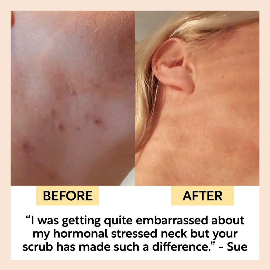 Face Scrub with Coffee + Rosehip Oil